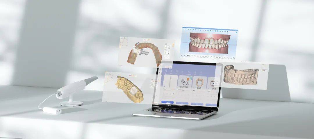 国内首家齿科数字化CAD/CAM软硬件研发企业落户拱墅，推动计算机系统集成创新发展